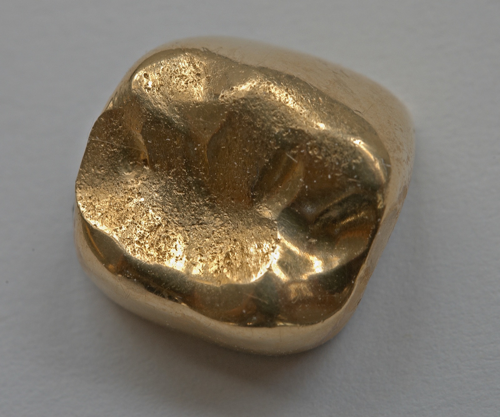 Photograph: solid gold dental crown seen in close-up