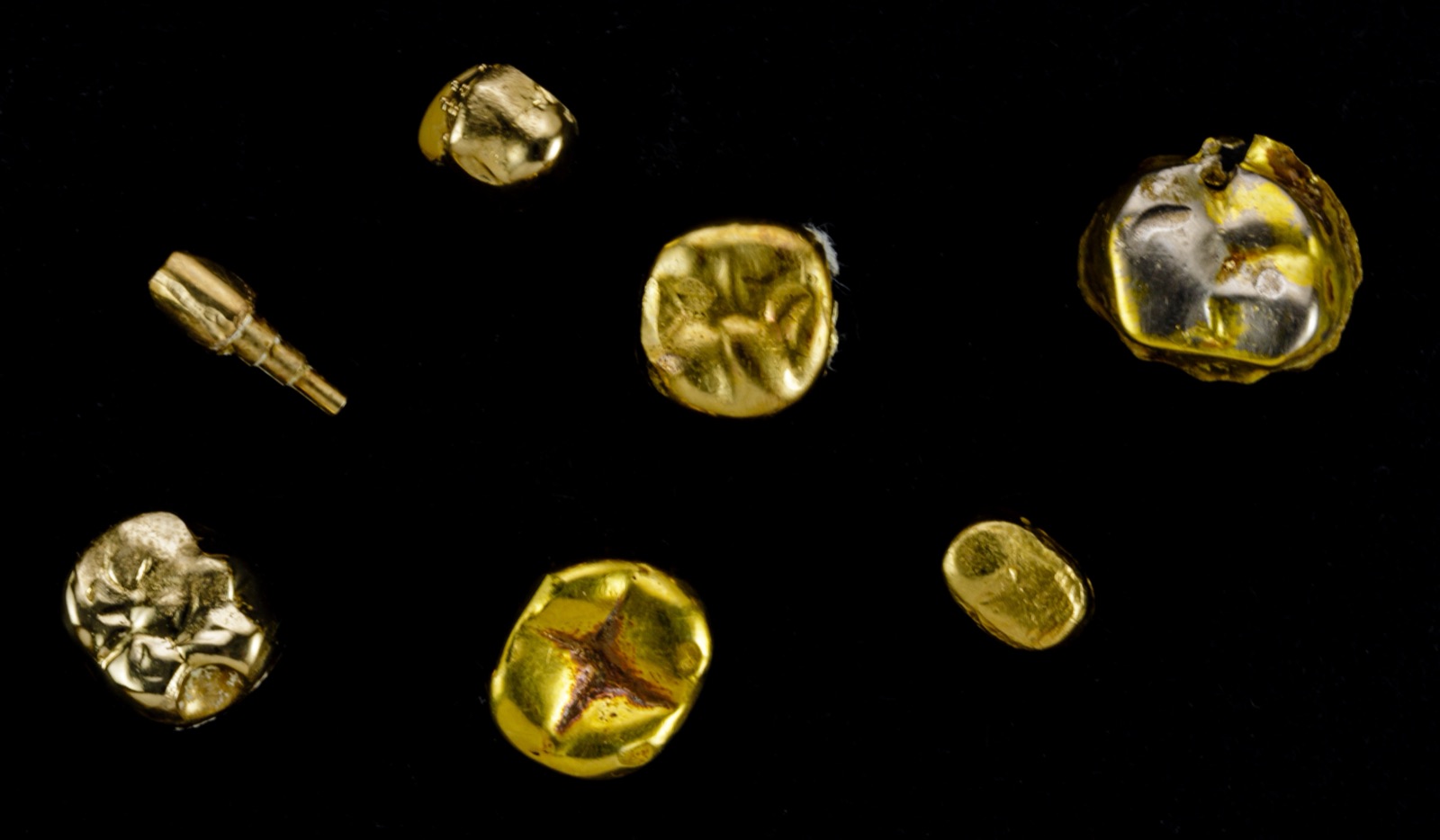 Photograph: a lot of dental gold on a black background, crowns, inlays and a gold post